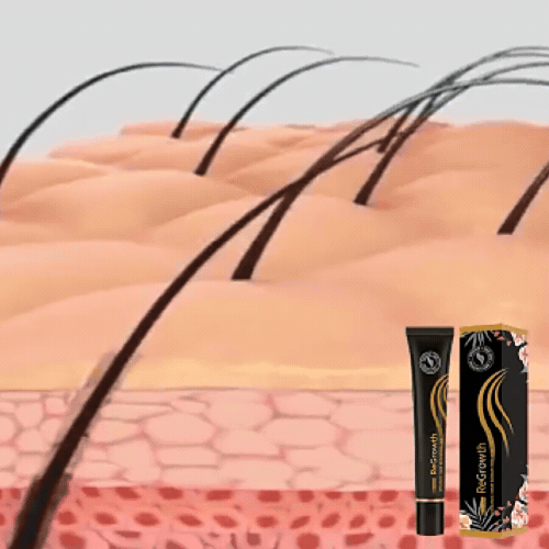 ForceRacine – this Strengthen Hair from the Root for Lasting Vitality
