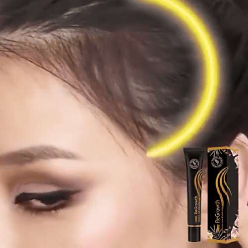 ForceRacine – this Strengthen Hair from the Root for Lasting Vitality