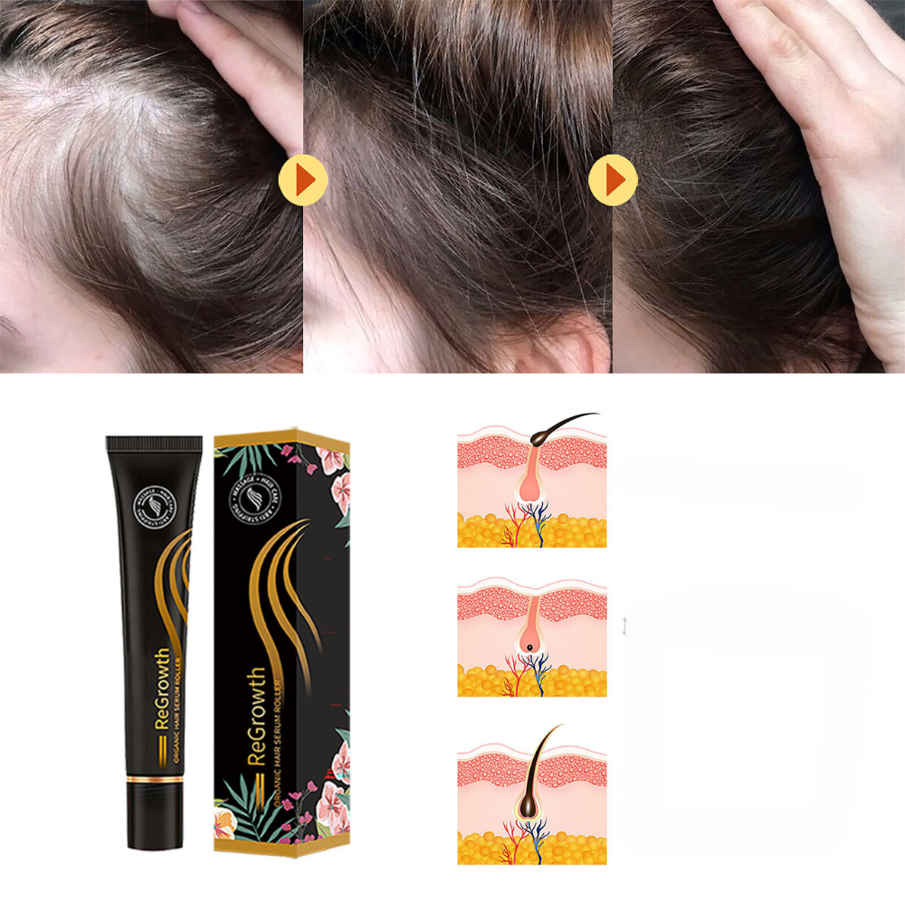 ForceRacine – this Strengthen Hair from the Root for Lasting Vitality 