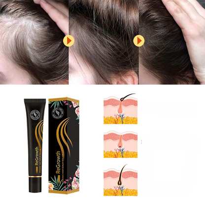 ForceRacine – this Strengthen Hair from the Root for Lasting Vitality 