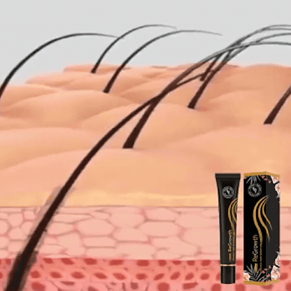 ForceRacine – this Strengthen Hair from the Root for Lasting Vitality 
